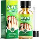 Toenail Fungus Treatment Extra Strength, Extra Strength 25% Undecylenic Acid Toe and Fingernail Fungus Removal, Natural Plant Extracts for Thick, Broken, Discolored, Gentle for All Ages 30ML