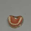 Dental Model Overdenture Inferior 2 Implants Demo for Studying and Teaching