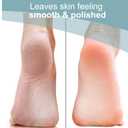 4 x Trim Neat Feet Foot Care Implements Double-Sided Pumice Stone, Callus Remover for Feet, Foot Scrubber for Dead Skin, Exfoliating Corn Removal, Cracked Heel Repair, Pedicure Tool, 1 Count