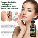 2 Pcs Cyperus Rotundus Oil for Hair Removal, Natural Cyperus Rotundus Oils to Reduce Unwanted Hair Growth, Soothing & Moisturizing, Shrinks Pores, Smooth Skin Care (2 Fl Oz (Pack of 2))