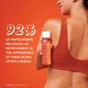 Bio-Oil Skincare Body Oil Serum, Face and Body Moisturizer with Vitamin E & A, for Scars, Stretch Marks, Sensitive Skin, All Skin Types, Dermatologist Recommended, Non-Comedogenic, 6.7 Oz