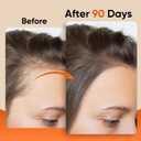 Batana Oil for Hair - 100% Raw, Cold Pressed, Unrefined & Organic Hair Mask - Prevents Hair Loss, Enhances Hair Thickness - For Men & Women, Essence for All Hair Types (8 oz)