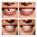 Tooth Repair kit for Filling The Missing Broken Tooth and Gaps-Moldable Fake Teeth and Thermal Beads Replacement Kit for Women and Men