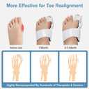 Bunion Corrector Toe Straightener: Big Toe Straightener Corrector - Bunion Thumb Corrector for Women Men