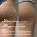 biotyspa Body Sculpt Cup - Medical Grade Silicone Anti-Cellulite Massage Tool for Lymphatic Drainage & Water Retention - Mimics French Palpate-Roll Technique for Firming - Designed in Australia