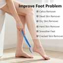 Pumice Stone for Feet with Long Handle 13.7", Hard Skin Callus Remover, Scrubber and Exfoliator for Dead Dry Skin, Softer & Smoother Feet, Pedicure Tool (Curved),Blue