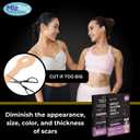 Breast reduction recovery supplies after surgery needs - Silicone scar sheets for surgical scars - Comfortable under Post op Bra