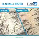 CeraVe Hydrating Anti Dandruff Shampoo, 1% Pyrithione Zinc Dandruff Treatment With Ceramides, Niacinamide & Hyaluronic Acid, Helps Eliminate Flakes & Provides Itchy Scalp Relief, Sulfate Free, 12 Oz