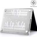 EooCoo Case Compatible with MacBook Pro 14 inch M5 2026-2021 M4 M3 M2 M1 Pro/Max Chip, Hard Shell Cases with Keyboard Cover, Screen Protector - Sparkly Clear
