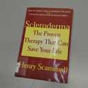 Scleroderma: The Proven Therapy that Can Save Your Life