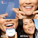 Crest 3D Whitestrips Professional Effects + LED Light Teeth Whitening Kit, 1 Light + 20 Treatments, Each with 1 Upper/1Lower, 40 Strips Crest 3DWhite Teeth Whitening Strips