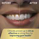 Waterpik Cordless Advanced 2.0 Water Flosser For Teeth, Gums, Braces, Dental Care With Travel Bag and 4 Tips, ADA Accepted, Rechargeable, Portable, and Waterproof, White WP-580