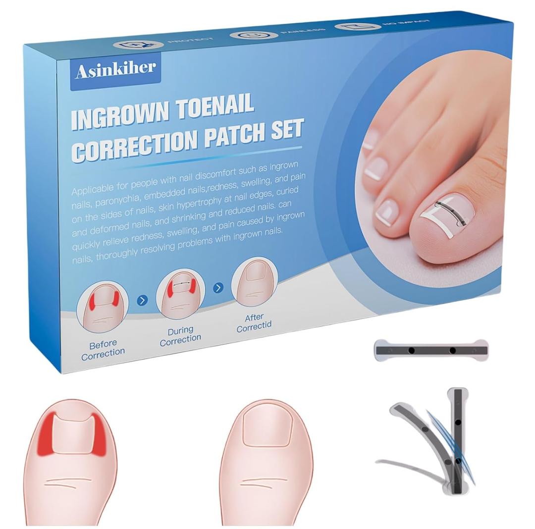 Titanium Alloy Ingrown Toenail Treatment, Ingrown Toenail Removal Kit for Curved Nail Repair, Ingrown Nail Tool for Home Use
