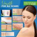 2 x Silicone Scar Sheets,Silicone Scar Tape, (1.6 x 60 Roll, 1.5M) Scar Removal Strips for Surgical Scars,Keloids, C-Section, & Burns Tummy Tuck Reusable Tape