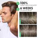 Dercos Selenium Sulfide Anti Dandruff Shampoo, Dry Scalp Treatment and Itch Relief. Prescription Strength Comparable to 2% Ketoconazole, for Mild to Severe Dandruff-Prone Hair & Flaky, Itchy Scalps (6.76 Fl Oz (Pack of 1))