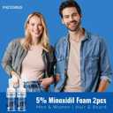 5% Minoxidil Foam, Minoxidil for Men Foam, Minoxidil for Women Hair Growth, Minoxidil for Men and Women. (4 Ounce)