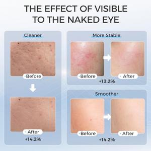 Led Face Mask Light Therapy, Red Light Therapy for Face, 7-1 Colors LED Facial Skin Care Mask