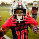 Battle Sports Triple Threat Wide Receiver Football Gloves, Ultra Stick Adult & Youth Gloves (Adult X-Large, Gold)