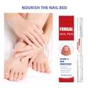Fungal Nail Renewal Pen for Toes & Fingernails, Nail Care Brush Pen to Help Restore Discoloration, Strengthen Thick & Brittle Nails, Supports Clearer and Healthier Looking Nails (2 PCS)
