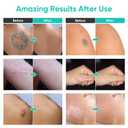 Tattoo Cover Up Makeup Waterproof, 2 Colors Professional Body Concealer Set, Long Lasting and Invisible Body Makeup Suitable for Vitiligo, Dark Spots, Scars