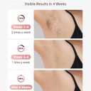 LYSMOSKI Laser Hair Removal, IPL Hair Removal with Ice-Cooling System for Painless & Long-Lasting Result, Safe At-Home Hair Remover Device for Armpits Back Legs Arms Face Bikini Line, Rose Gold