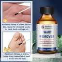 SKAYAH Wart Remover Freeze Off - Professional Strength Wart Remover Liquid - 5% Salicylic Acid Fast-Acting Treatment for Plantar Wart,Flat Wart, Corn and Callus Remover, 15ml (0.5 fl oz)-H236