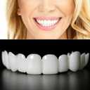 2 Pairs of Smile Supports, Quickly Restore Smile and Regain Confidence (White) Adjustable Comfort.