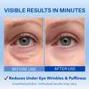 Instant Under Eye Tightening Serum Puffiness, Wrinkles & Dark Circles | Advanced Polysaccharide Eye Serum for Mature Skin 20 mL