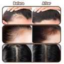 2 x HAIOLORPRO Root Touch Up Powder Hair Color Dark Brown, Root Cover Up Hair Powder for Women Scalp Concealer, HairlinePowder for Women GrayHair