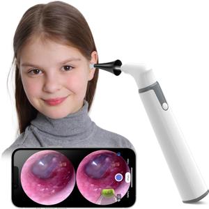 ScopeAround Otoscope with Light, Ear Camera with Dual View, 720pHD WiFi Ear Scope with 6 LED Lights, 3.9mm Lens Otoscope Camera for Kids and Adults, Ear Scope Compatible w/Android and iPhone