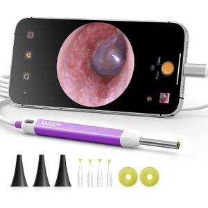 Anykit Visual Ear Wax Removal Camera, Type-C Digital Otoscope with 6 LED Lights and Ear Camera with Earwax Removal Tool for Adults & Children, Compatible with iPhone 15& Android (Purple)