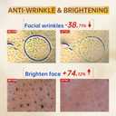 Vitamin C Face Serum with Vitamin C, Hyaluronic Acid, Vitamin E, Serum for Dullness, Balanced Complexion, Eye Area, Fine Lines & Wrinkles, 60ml/2.02oz