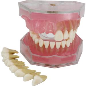 Dental Implant Teeth Model with Removable Teeth for Dental Professionals and Students