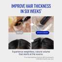 ViveLab Scalp Microneedle Serum K-beauty Hair Growth & Scalp Treatment with Spioxyl 400 | Fills Hair Part Line, Strengthens Roots, Reduces Hair Thinning 220,000 Microneedle Formula