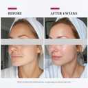 Colorfarm Facial Steamer Nano Ionic: Large 3-in-1 Face Steamer Deep Cleaning Unclogs Pores - Humidifier Towel Steamer Hot Mist Home Sauna Spa for Women Men Sinuses Moisturizing (5 Piece set)