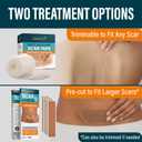 NUVADERMIS Silicone Scar Sheets - Extra Long Scar Sheets for C-Section, Tummy Tuck, Keloid, and Surgical Scars - Reusable Medical Grade Silicone Scar Sheets - Pack of 4 - Light Tone