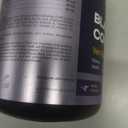 Dog UTI Treatment - Bladder Control Cranberry Chews - Cranberry Supplement for Immune Function, Urinary Tract, Bladder & Kidney Health - D-Mannose Soft Treats for Dog Incontinence - All Breeds & Ages (130 Count (Pack of 1))