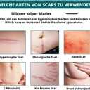 Silicone Scar Tape, (1.6X116 inches), Silicone Scar Tape for Scar Removal Treatment, Suitable for Caesarean Section, Scars, Burns, Acne, Surgical Scars