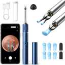 Qimic Ear Camera with Tweezers - Ear Cleaner with Camera, 1080P HD Earwax Removal Tool with Light, IP67 Ear Cleaning Kit with 6 Ear Spoon, Ear Camera Otoscope for iPhone, Android