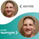 Temptooth Tooth Replacement Product with Coloring Material