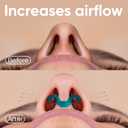 Brison Nasal Dilators for Breathing and Sleeping - 3 Pack Anti Snoring Nose Vents Opener for Better Breathing Sleeping and Activity Improves Airflow - Soft