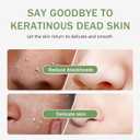 2 x Purifying Exfoliating Gel with Face Washing Brush, Exfoliating Face Wash, Deep Cleansing Peeling Gel for the Whole Body, Facial Scrub Exfoliator, Oil & Dirt Cleanser for All Skin Types (2PCS)