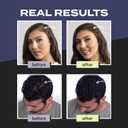 Toppik Hair Building Fibers, Fill In Fine or Thinning Hair Instantly Thicker, Fuller Looking Hair 9 Shades,4 size options, EXP: Unknown
