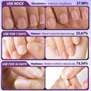 Upgrade 3-in-1 Nail Care Pen, Cuticle Pusher Pen Cuticle Oil Pen for Nails, Cuticle Pusher Nail Oil Pen with Ceramic Tip for Hangnails, Moisturize Strengthen Nails Care (2 Pcs)