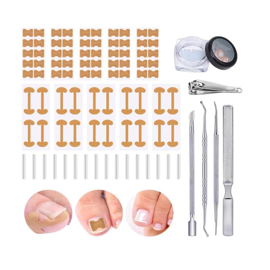 Ingrown Toenail Corrector Set with Correction Strips, Professional Ingrown Toenail Removal Kit, Toenail Correction Strips & Ingrown Toenails Pedicure Tool Set for Home Pedicure Care