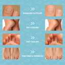 Foot Mask Moisturizing Socks for Dry Cracked Feet | Hydrates with Snail Mucin Shea Butter Hyaluronic Acid Bisabolol Vitamin E | Exfoliating Foot Mask for Callus Removal Dead Skin and Soft Feet