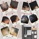 The ORIGINAL Thinning Hair and Hairline Concealer, Natural Hair Mascara for Balding Areas, Root Touch-Up for Thicker Appearance (Natural Brown FBA)