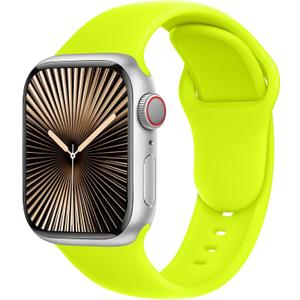 C1B band for Apple Watch bands for women apple watch band iwatch bands ultra 2 band series11 10 9 8 7 6 5 4 3 2 1 se men 45mm 44mm 40mm 41mm 38mm 42mm 49mm,Fluorescent Yellow