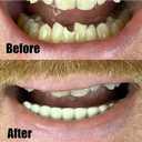 Instant Smile Comfort Fit Flexible Lower Teeth