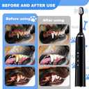 Dog Teeth Cleaning Kit, Sonic Toothbrush for Pets, Teeth Plaque Remover Brush Set with 3 Modes and 11 Replaceable Heads